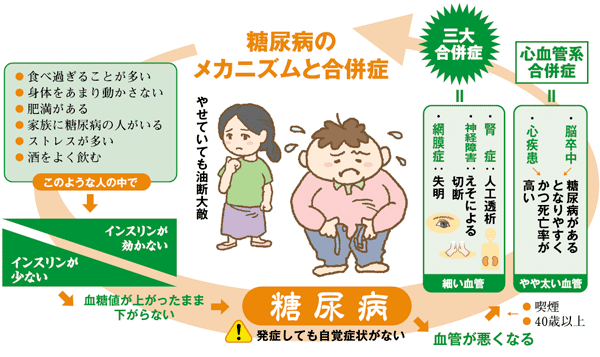 『サイレントキラー』 糖尿病は自覚症状のない病気
